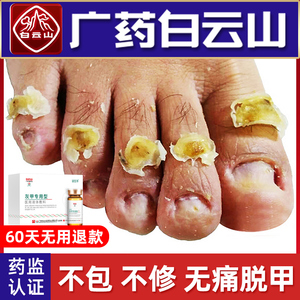灰指甲专用脱甲膏抑菌液日本冰醋酸涂剂非治疗增厚型药旗舰店正品