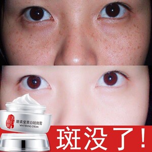 脸上有黑色斑祛斑霜