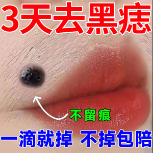 去痣点痣膏神器祛痣无痕祛斑痦子肉痣雀斑脸部全身去黑痣黑点药水