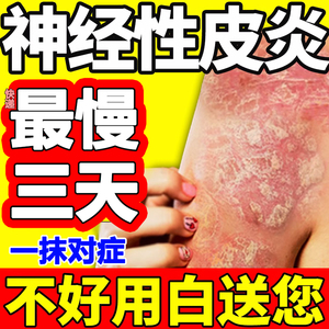 北京同仁堂过敏性皮炎膏过敏感性皮肤面部脂溢性皮炎湿疹痤疮药膏