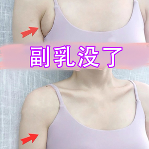【副乳没了】去副乳神器 腋下结节颈部淋巴散结膏 收副乳消除贴