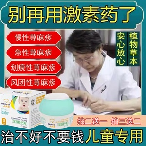 治疗儿童急慢性寻荨麻疹过敏止痒断根胆碱能风团性丘疹性专用药膏