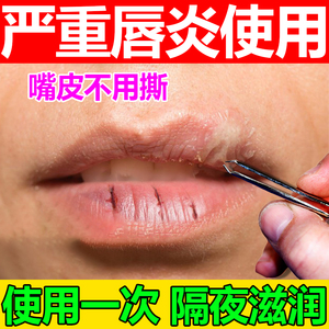 明华堂大药房旗舰店天猫云植盐酸金霉素眼膏修复药膏唇炎专用药唇膏