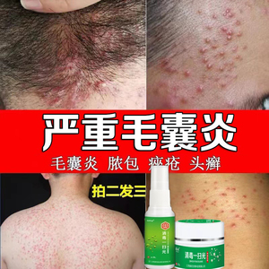 专治毛囊炎药膏