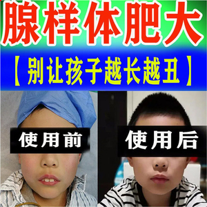 【3天全愈】腺样体肥大中药贴调理儿童睡觉鼻塞张嘴打呼面容矫正