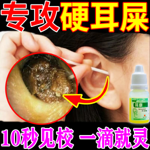 耳屎软化液掏耳勺带灯充电耳朵油耳垢耵聍结石软化滴耳液专业护理