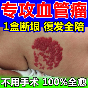 血管瘤婴儿专用药去除樱桃海绵草莓状蔓状瘤毛细血管痣神器修复膏