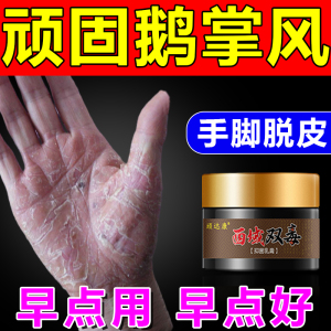 鹅掌风手藓真菌感染汗疹疱手脚脱皮干裂软膏藓水泡手气脚专用膏药
