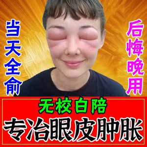 消眼肿神器消除眼睛周围红肿水肿去上眼皮肿专用眼睛浮肿泡泡眼贴