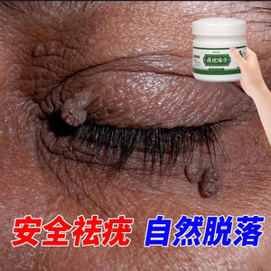 痦子去除膏去猴子脖子上长小肉粒疙瘩皮赘药肉瘤凸tb167740550同