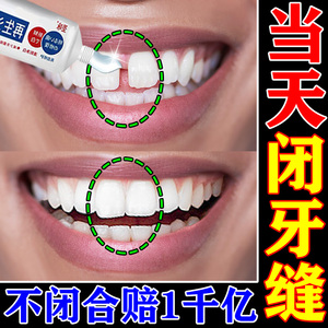 日本再生硅补牙缝神器补牙齿牙缝牙膏填充门牙牙缝宽大专用修补剂