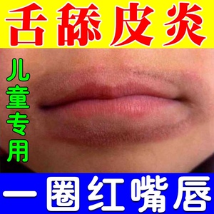 茹春堂医疗器械旗舰店天猫唇炎专用药膏口角炎儿童成人嘴巴上火起泡