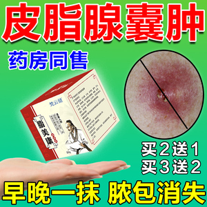 皮脂腺囊肿拔毒膏药粉瘤痘痘调理皮下毛孔堵塞脓包祛除火疖子神器