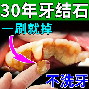 【一刷就掉】去牙结石牙膏美白去黄去口臭口气清新蜂毒牙膏去除器