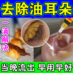 耳神器耳结石挖耳朵儿童耵聍水清理耳勺清洁器耳垢剂珍视维旗舰店