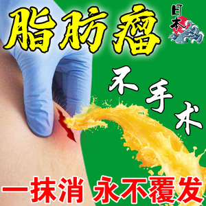 脂肪瘤去除神器消除硬块专用消瘤膏治多发性表皮囊肿皮下肉瘤克星