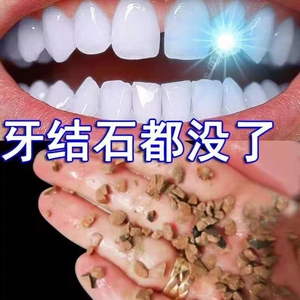 掏剔抠牙结石神器扣牙石清理刮牙垢器清除工具去除器头专业声波