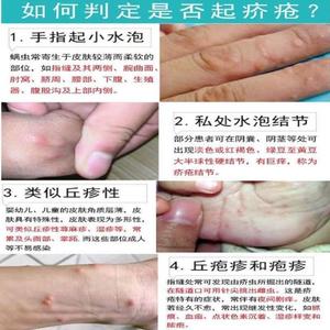 新款 去根结节一扫光特效药去膏药干疮膏止痒外用疥疮药8.