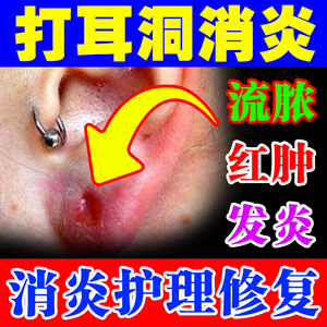 耳洞消炎护理液非耳棒耳洞养护防发炎清洁水消毒滴中耳炎专用药膏