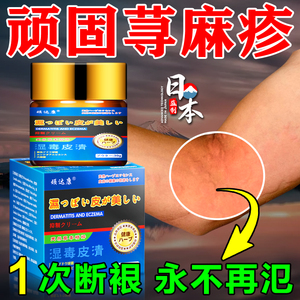 荨麻疹过敏止痒断裉专用膏湿疹皮炎季节性丘疹性特效日本进口药膏