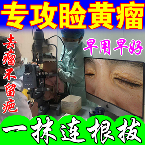 去睑黄瘤膏治疗汗管瘤眼部脂肪粒去除神器消眼睑黄斑瘤克星专用药