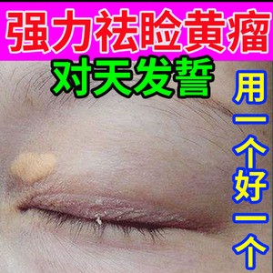 去睑黄瘤脂肪粒汗管瘤眼部祛黄色瘤圆脸黄斑黄睑瘤黄斑凸起专用膏