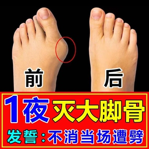【包跟治】拇指外翻矫正器女男大脚骨脚趾重叠变形医用可穿鞋膏贴