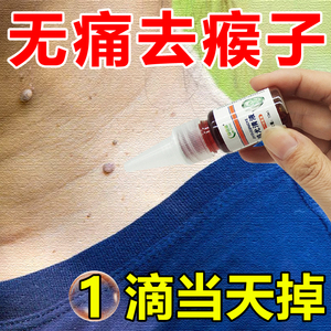 去脖子上的小肉粒疙瘩肉瘤猴子皮赘专用药去痣疣丝状疣脖子去除膏