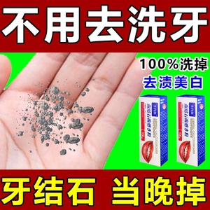 一口净去牙结石牙膏去除牙垢黄牙口臭牙结石溶解牙石速效专用神器