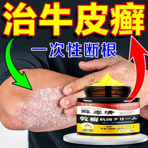 【日本神膏】牛皮藓银屑病癣股癣手足头皮癣疹湿止痒去根专用药膏