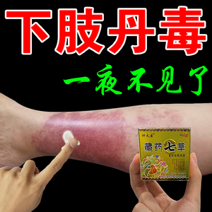 丹毒软膏皮肤红肿【一夜不见】疼痛发热灼烧水肿红斑湿热下注药膏