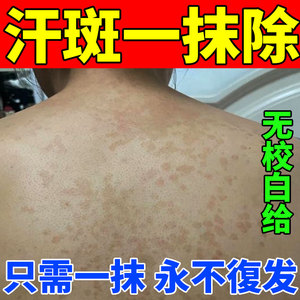 汗斑专用药治疗胸前腋下后背白斑花斑褐斑皮肤外用止痒药