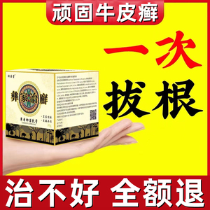 牛皮癣藓银屑病皮肤癣手足股头皮癣治疗湿疹止痒去根专用特效药膏