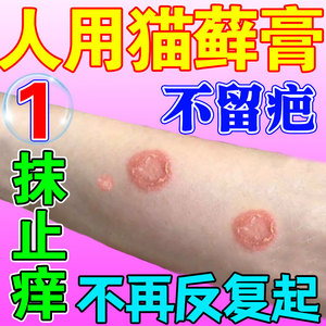 人用的猫癣药