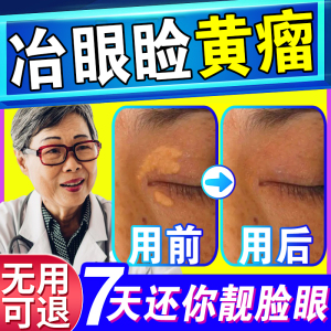 去除睑黄疣药膏眼部祛黄色瘤圆脸黄斑黄脸瘤康脸眼睑黄瘤膏专用膏