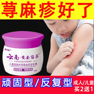 治疗婴儿童划痕荨麻疹过敏止痒根断专用药膏胆碱能性慢性丘疹去根