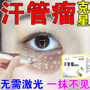 治疗汗管瘤专用药膏眼部去除神器脂肪粒祛面部油脂粒栗丘疹扁平疣