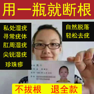 治疗尖锐湿疣克星男女性私处中药去除丝状疣扁平疣专用药膏克优净