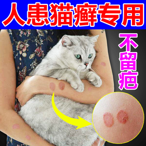 人用猫藓药治皮肤真菌感染瘙痒癣斑人得猫癣抑菌止痒专用药膏外用