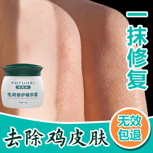 毛周角化去鸡皮肤疙瘩毛囊角质化药膏去除神器去鱼鳞皮肤蛇皮腿