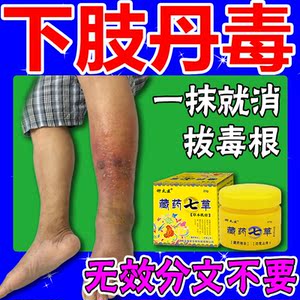 【一抹就消】下肢丹毒湿热引起小腿红斑水肿流火皮肤疼痛灼烧软膏