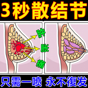 散结乳房结节【一喷散】乳腺结块胀痛硬块专用喷剂纤维瘤经前胀痛