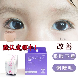 倒睫毛矫正贴倒睫毛矫正贴儿童下睫毛倒睫贴胶带眼睑内翻婴儿小孩