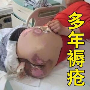 000人付款淘宝褥疮专用药膏药粉压