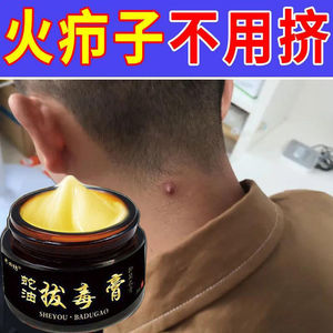 正品火疖子拔毒拔脓膏治屁股坐板疮肿硬块药祛闷头吸脓浓疮包神器【买