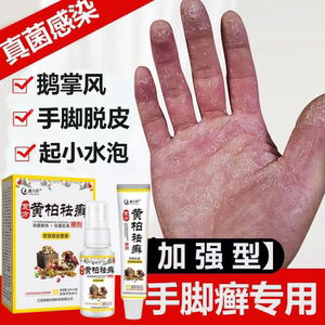 汗疱疹汗孢疹汗泡疱疹药膏汉汗状疱疹手上小水泡克星鹅掌风专用膏