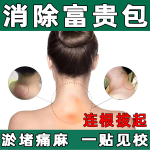 富贵包消除贴修复颈部大椎鼓包肩颈酸硬疼痛专用膏贴