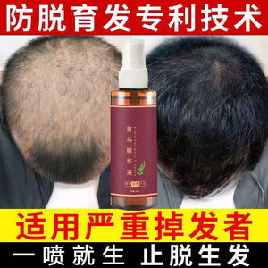 【脱发一喷猛涨】生发液秃顶脂溢性头发快速增长发际线防脱育发剂