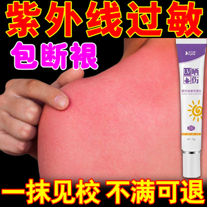 紫外线过敏药膏日光性皮炎修复太阳晒伤皮肤发痒成人儿童专用软膏