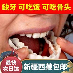 新疆西藏包邮万能牙套吃饭神器咀嚼通用无孔老人仿真假牙补牙美白